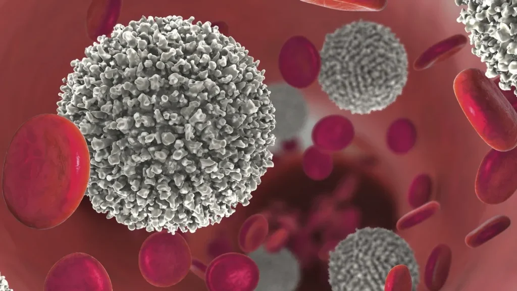 Quali sono i primi sintomi di una leucemia?