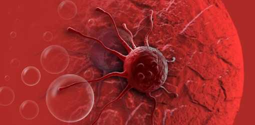 Quale tipo di leucemia è curabile?