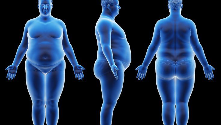 Quando una Persona è Considerata Obesa?