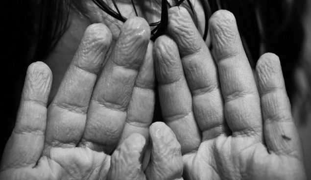 Cosa fare per la pelle raggrinzita?