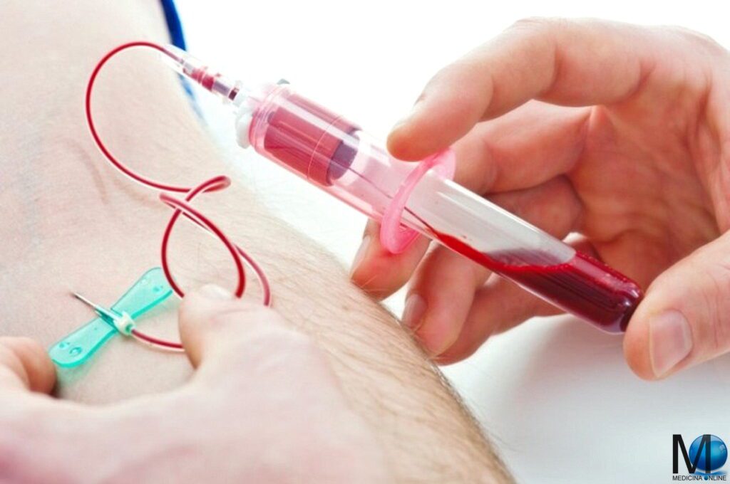 Cosa non fare prima del prelievo del sangue?