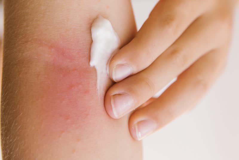 Quale malattia neurologica porta prurito?