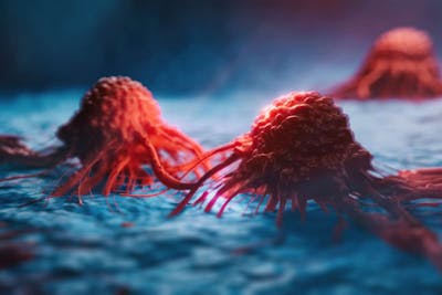 Qual &egrave; la differenza tra un tumore e un carcinoma?