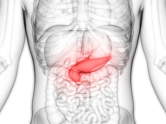 Quando sospettare un tumore al pancreas?