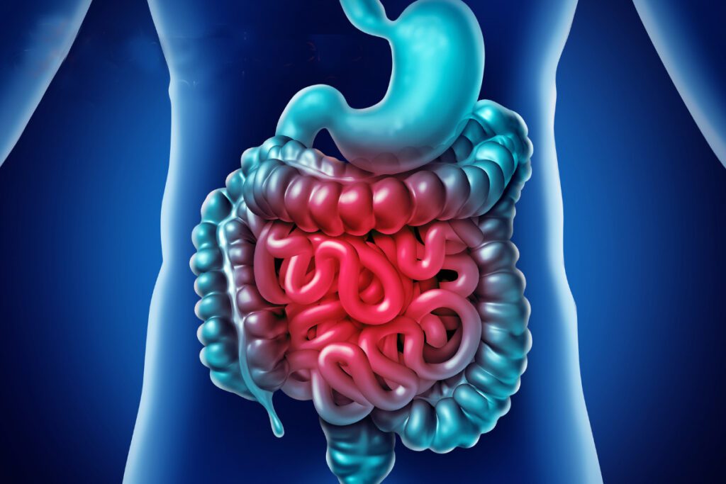 Cosa fare per eliminare i diverticoli?