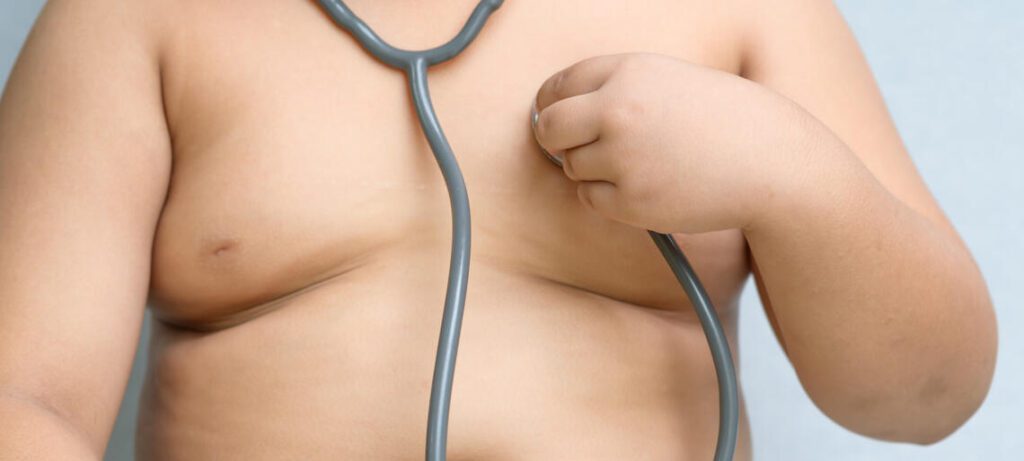 In quanto tempo si diventa obesi