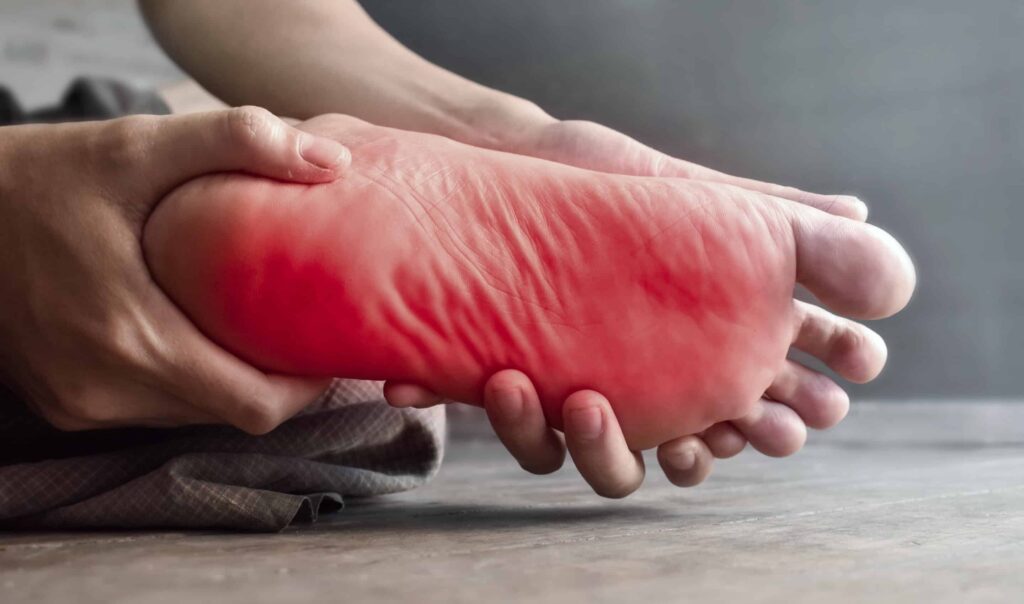 Neuropatia Periferica e Dolore alle Gambe