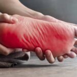 Neuropatia Periferica e Dolore alle Gambe