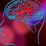 Nutrizione per la Prevenzione dell'Ictus