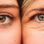 Uova e invecchiamento della pelle