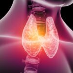Influenza dello iodio sulla salute della tiroide