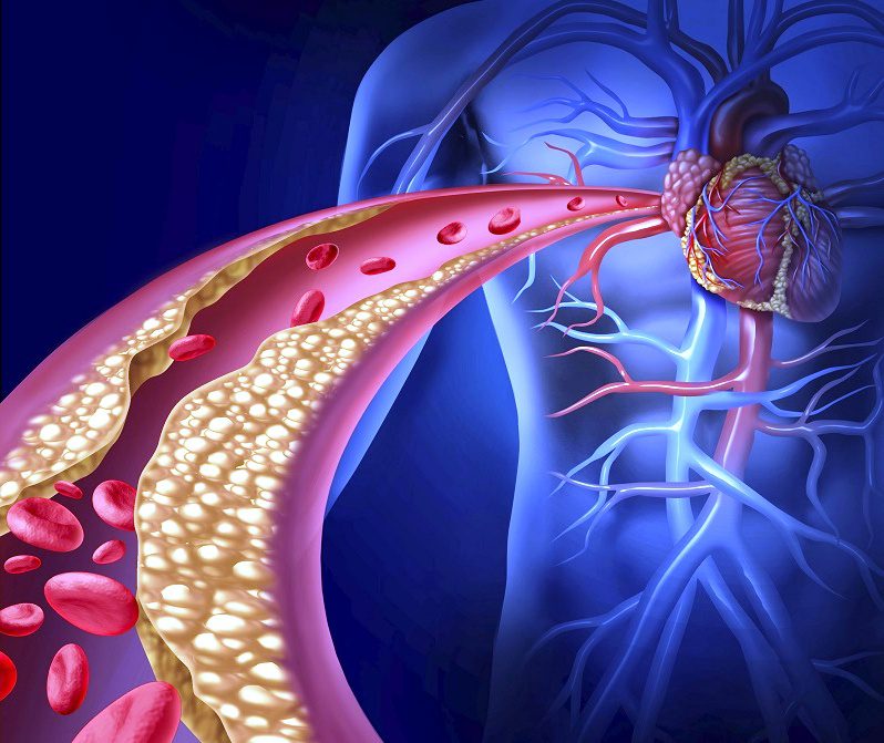 Prevenzione dell'ipercolesterolemia
