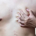 Impatto della salute cardiovascolare sulla pelle