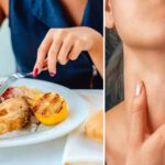 Dieta povera di iodio e sviluppo di problemi alla tiroide