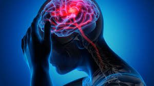 Riduzione del rischio di stroke