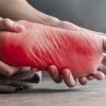 Segnali precoci della neuropatia periferica