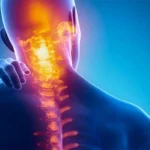 Cervicale e mal di testa forte