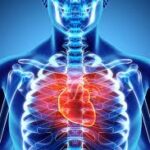 L’aumento delle malattie cardiovascolari