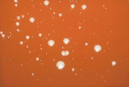 Diagnosi della malattia. Colonie di Bartonella quintana su agar cioccolato, di dimensioni variabili, appiattite e lisce