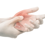 Dolore alle mani post allenamento
