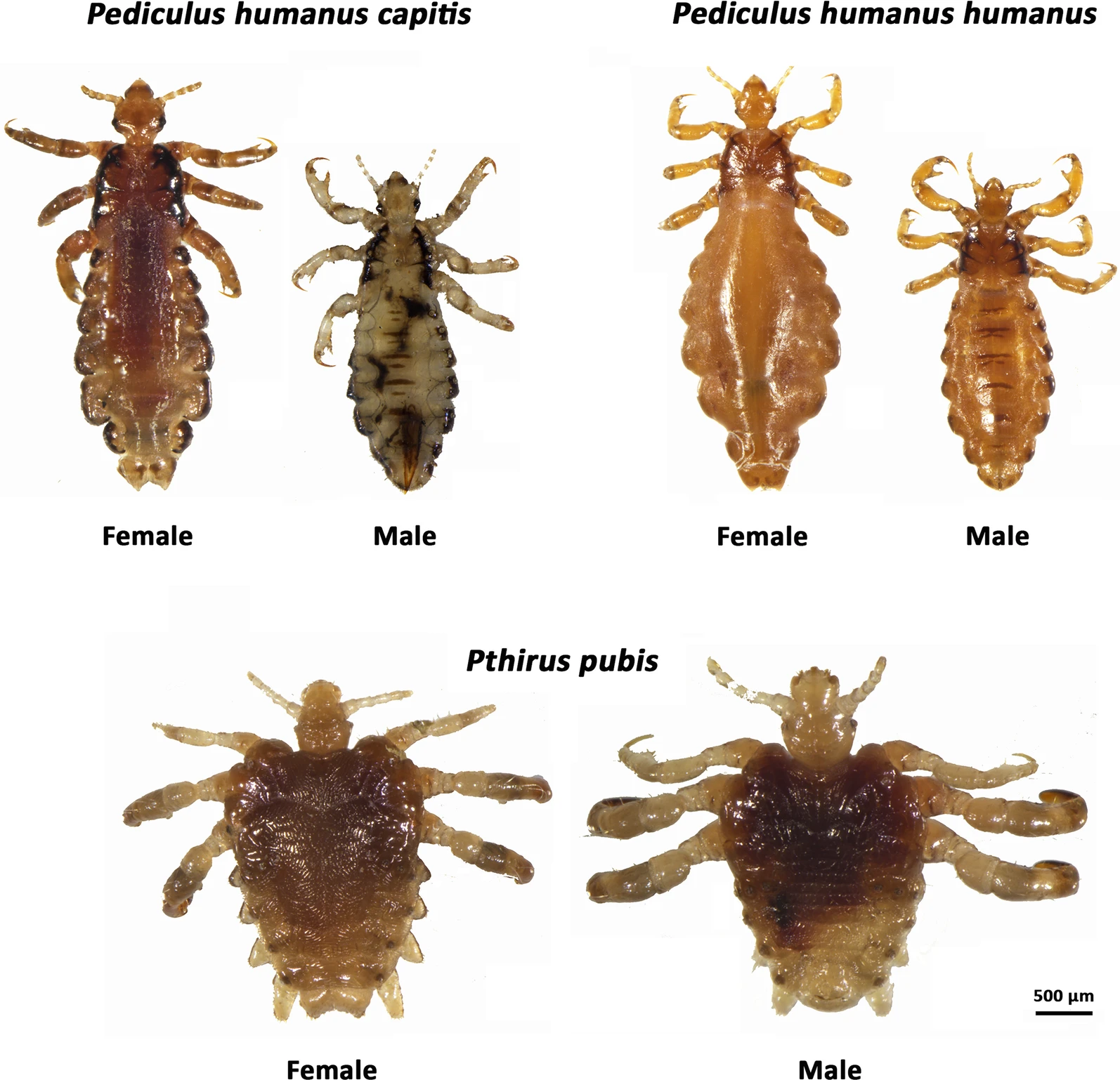 I pidocchi sono gli organismi vettore di Bartonella quintana e della malattia conosciuta come febbre delle trincee