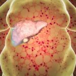 Problemi al fegato negli adolescenti