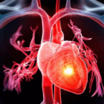 Fasi dello scompenso cardiaco