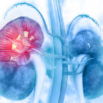 Malattia renale cronica