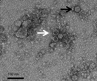Immagine al TEM di capsidi incompleti (freccia bianca) e capsidi completi (freccia nera) del virus delle ali deformi. 