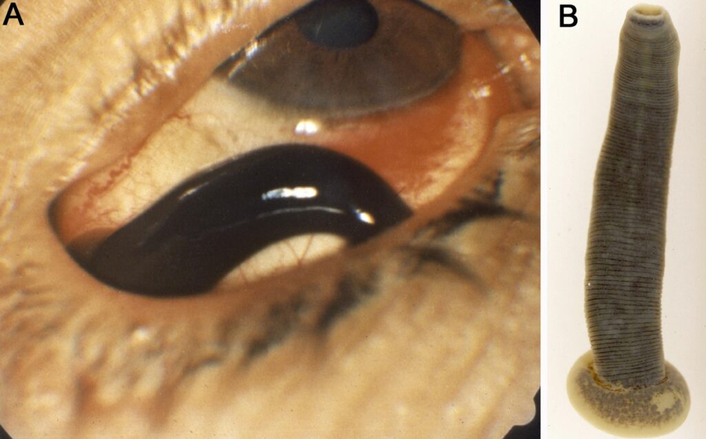 Le sanguisughe possono occupare un'ampia varietà di sedi anatomiche, comprese le mucose. In questo caso (A) Dinobdella ferox ha parassitato l'occhio di un cane; (B) immagine anatomica di D. ferox
