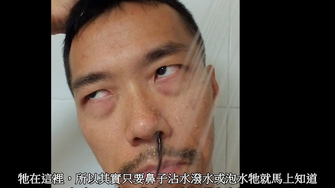 Yi-Te Lai, durante il periodo di infestazione volontaria con Dinobdella ferox. La sanguisuga, fuoriesce dalla sua narice, mentre lo scienziato sta facendo la doccia