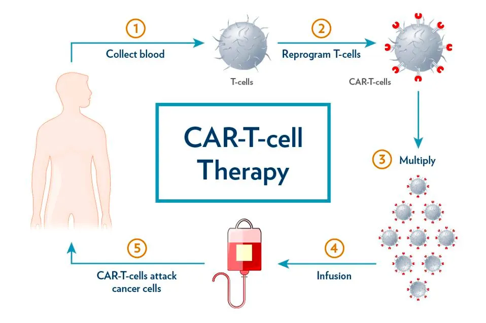 Cura per il cancro: CAR-T