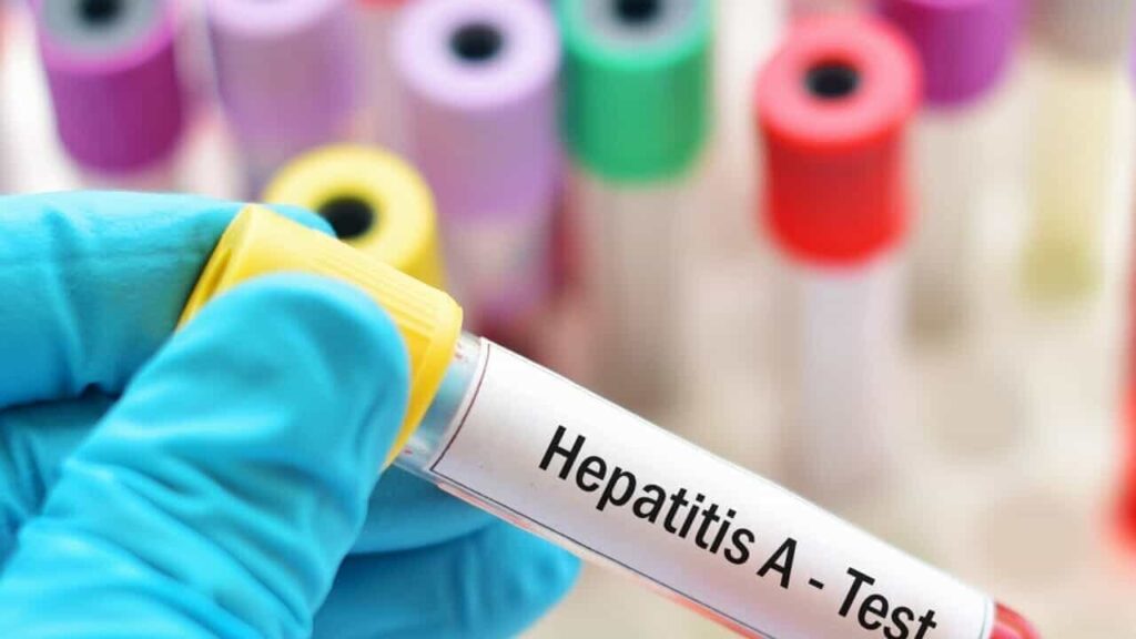 Misure Igieniche per Prevenire il Contagio da Epatite A