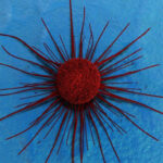 Cancro il segnale precoce che molti ignorano