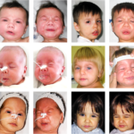 Come capire se si ha una malattia rara ed aggressiva