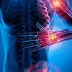 Dolore cronico cosa lo peggiora ogni giorno