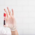 Il valore nel sangue che devi controllare subito