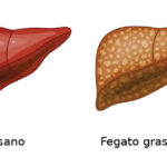 Quali analisi del sangue fare se hai il fegato grasso