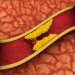 Questo errore quotidiano alza il colesterolo