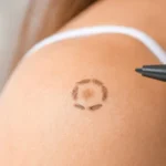 neo dermico cambio forma