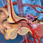 Cosa succede quando sopraggiunge l'infarto timpanico?