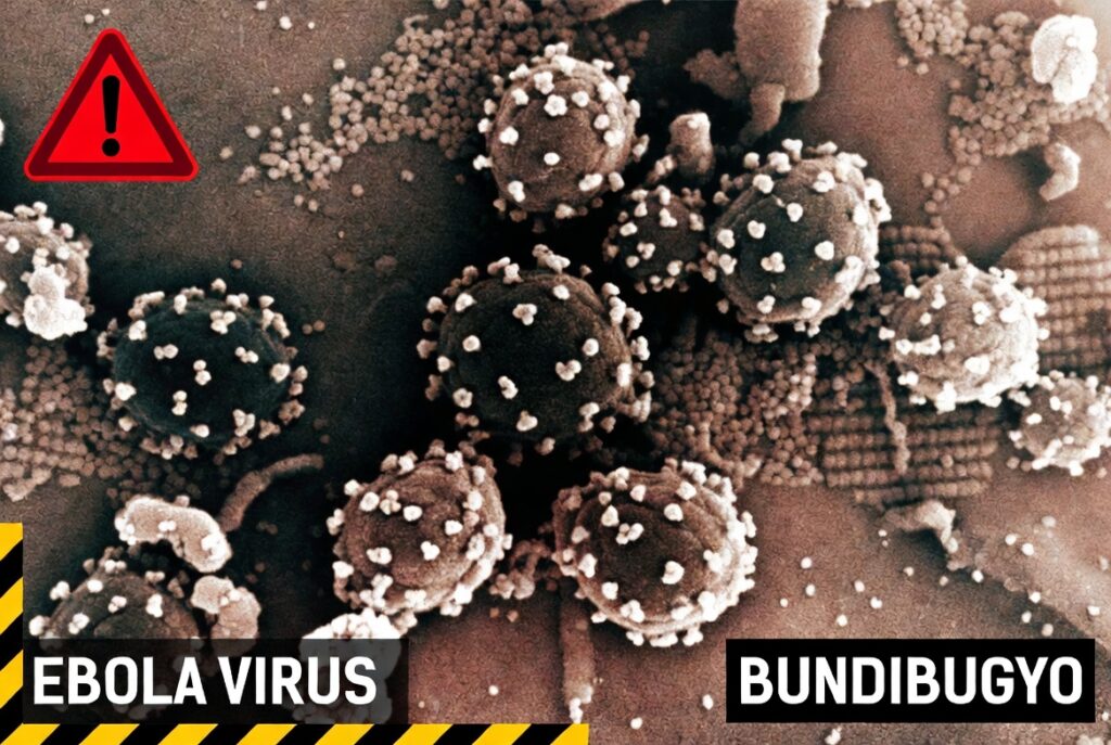 La Peggiore Epidemia di Ebola Bundibugyo
