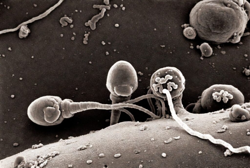 Apicomplexa (phylum)