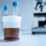 Perchè si fanno sempre le urine scure e maleodoranti?