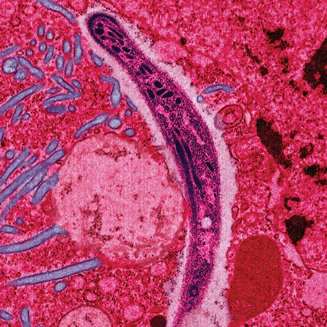 Phylum Apicomplexa Plasmodium