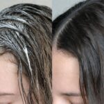 capelli grassi, cause, conseguenze e rimedi