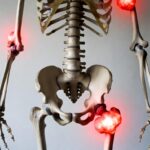 3 segnali fondamentali per capire di avere un tumore osseo