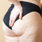 3 trucchi a tavola per combattere la cellulite