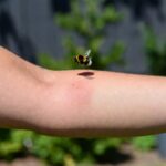 Cosa fare se ti punge un bombo nel braccio