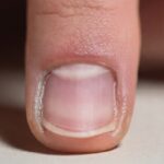 Cosa significa quella parte bianca che compare alla base dell'unghia?